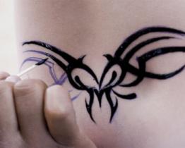 La rimozione del tatuaggio